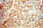 TNNC1 Antibody in Immunohistochemistry (Paraffin) (IHC (P))