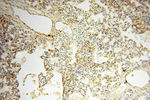 TNNC1 Antibody in Immunohistochemistry (Paraffin) (IHC (P))