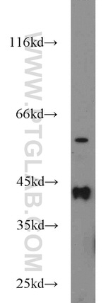 ATX3/ATXN3 Antibody in Western Blot (WB)