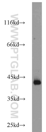 ATX3/ATXN3 Antibody in Western Blot (WB)