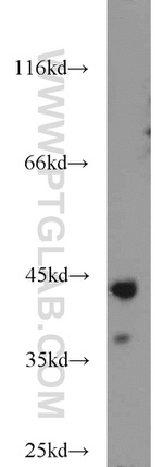 ATX3/ATXN3 Antibody in Western Blot (WB)