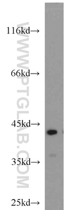 ATX3/ATXN3 Antibody in Western Blot (WB)