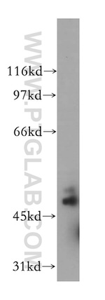 ATX3/ATXN3 Antibody in Western Blot (WB)