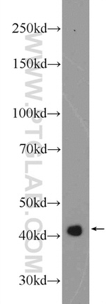 ATX3/ATXN3 Antibody in Western Blot (WB)