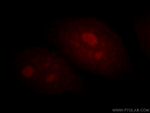 BATF Antibody in Immunocytochemistry (ICC/IF)