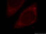 MTPN Antibody in Immunocytochemistry (ICC/IF)