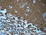 MTPN Antibody in Immunohistochemistry (Paraffin) (IHC (P))