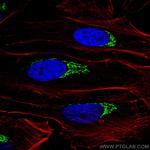 p115/USO1 Antibody in Immunocytochemistry (ICC/IF)