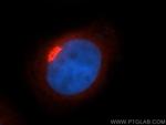 p115/USO1 Antibody in Immunocytochemistry (ICC/IF)