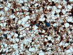 p115/USO1 Antibody in Immunohistochemistry (Paraffin) (IHC (P))