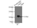 p115/USO1 Antibody in Immunoprecipitation (IP)