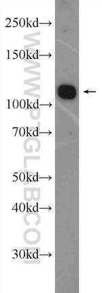 p115/USO1 Antibody in Western Blot (WB)