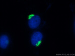 p115/USO1 Antibody in Immunocytochemistry (ICC/IF)