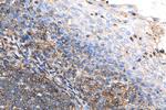 Beta-2-microglobulin Antibody in Immunohistochemistry (Paraffin) (IHC (P))