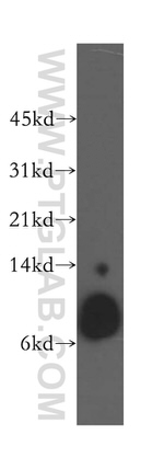 Beta-2-microglobulin Antibody in Western Blot (WB)
