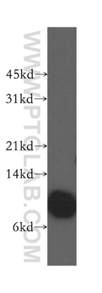 Beta-2-microglobulin Antibody in Western Blot (WB)