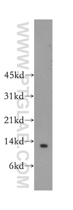 Beta-2-microglobulin Antibody in Western Blot (WB)