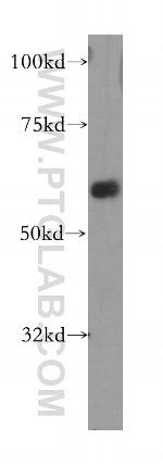 MARVELD2 Antibody in Western Blot (WB)