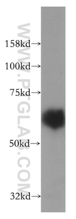 MARVELD2 Antibody in Western Blot (WB)