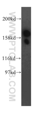 EIF5B Antibody in Western Blot (WB)
