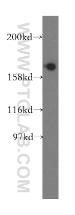 EIF5B Antibody in Western Blot (WB)