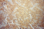 TDRKH Antibody in Immunohistochemistry (Paraffin) (IHC (P))