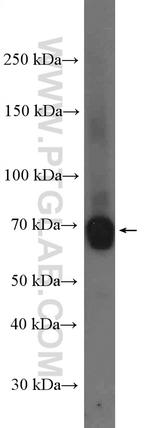 TDRKH Antibody in Western Blot (WB)