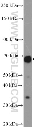 TDRKH Antibody in Western Blot (WB)