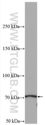 EML2 Antibody in Western Blot (WB)