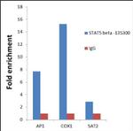 STAT5 beta Antibody