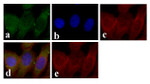 STAT5 beta Antibody in Immunocytochemistry (ICC/IF)