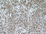 PAK6 Antibody in Immunohistochemistry (Paraffin) (IHC (P))