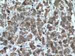 PAK6 Antibody in Immunohistochemistry (Paraffin) (IHC (P))