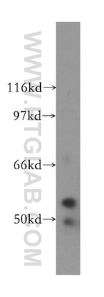 PAK6 Antibody in Western Blot (WB)