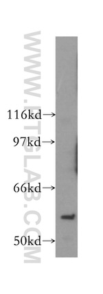 PAK6 Antibody in Western Blot (WB)