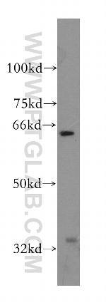 PAK6 Antibody in Western Blot (WB)