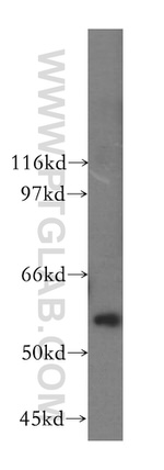 PAK6 Antibody in Western Blot (WB)