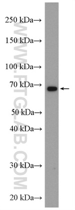 PAK6 Antibody in Western Blot (WB)