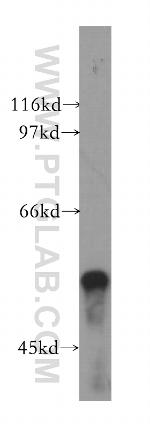 TBL1X Antibody in Western Blot (WB)