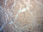 CROT Antibody in Immunohistochemistry (Paraffin) (IHC (P))