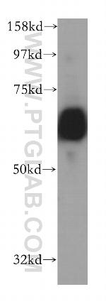 CROT Antibody in Western Blot (WB)