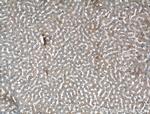 Alpha-2-macroglobulin Antibody in Immunohistochemistry (Paraffin) (IHC (P))