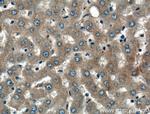 Alpha-2-macroglobulin Antibody in Immunohistochemistry (Paraffin) (IHC (P))