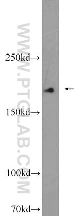 Alpha-2-macroglobulin Antibody in Western Blot (WB)