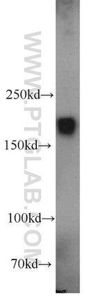 Alpha-2-macroglobulin Antibody in Western Blot (WB)