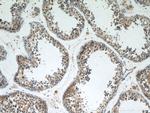 ST3GAL4 Antibody in Immunohistochemistry (Paraffin) (IHC (P))