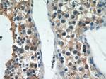 ST3GAL4 Antibody in Immunohistochemistry (Paraffin) (IHC (P))