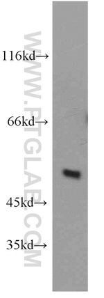 ST3GAL4 Antibody in Western Blot (WB)