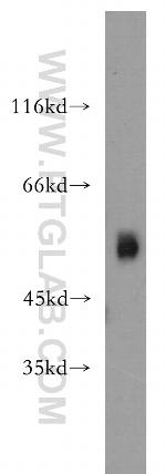 ST3GAL4 Antibody in Western Blot (WB)