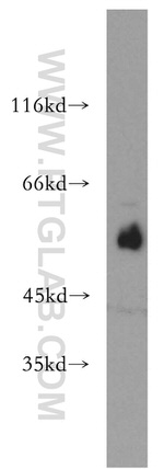 ST3GAL4 Antibody in Western Blot (WB)